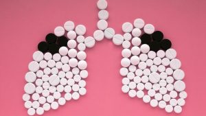 Kemenkes Respons Klaim Influencer Sebut Herbal Bisa Cegah-Obati TBC